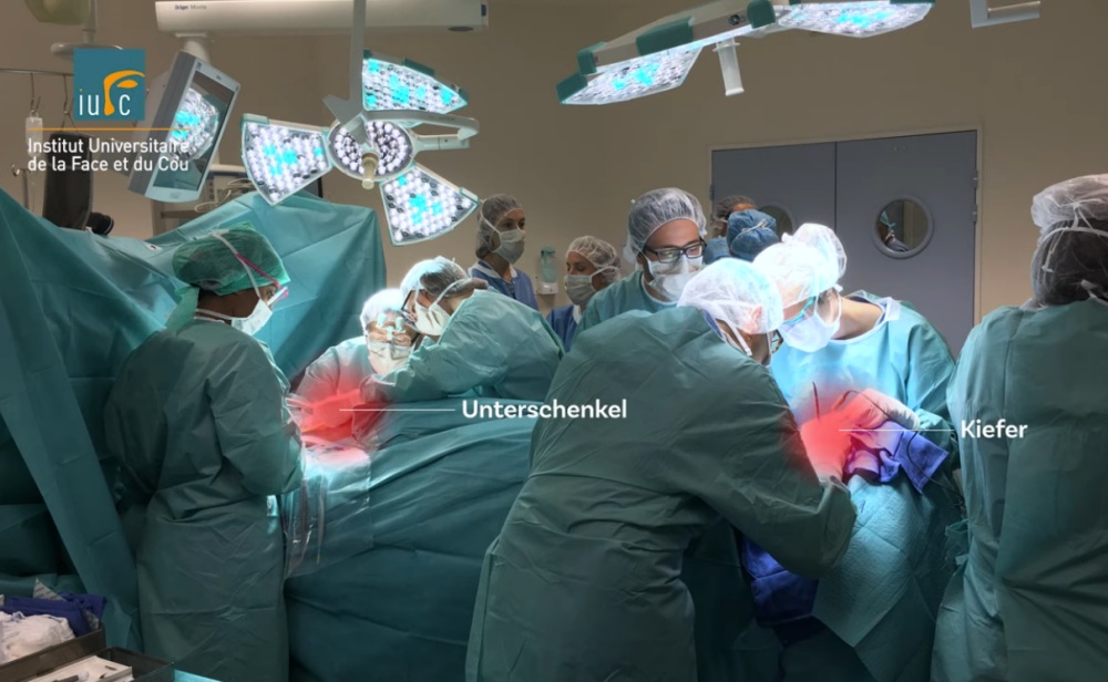 exocad-Video: Ein Wadenbein wird zum Unterkiefer exocad-Video: Ein Wadenbein wird zum Unterkiefer