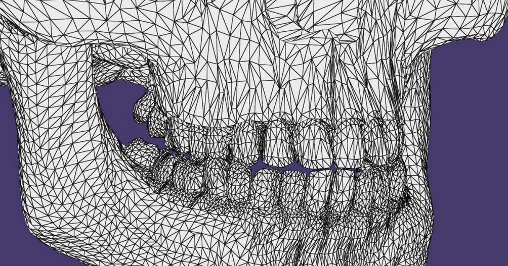 FH Kärnten: Neuer Studiengang „Digitale Dentaltechnik“ ab 2023
