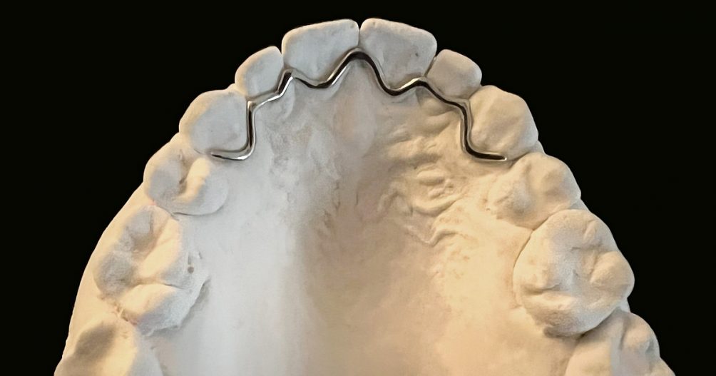 Retainer im SLM-Verfahren von Flussfisch