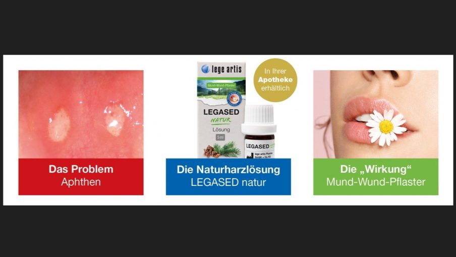 Aphthe, Aphte oder Afte? Hauptsache weg!