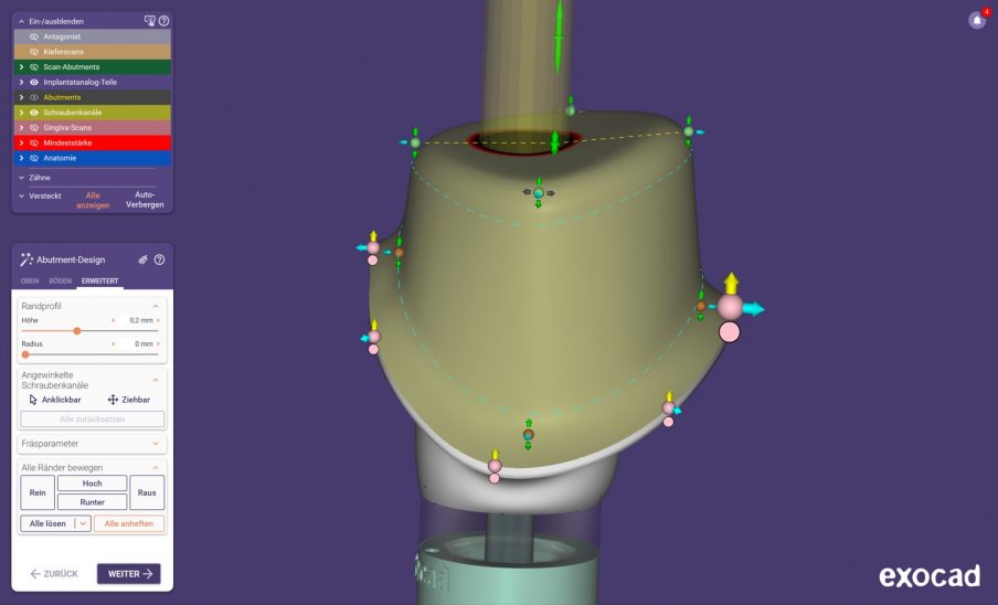 exocad DentalCAD: Abutment-Video