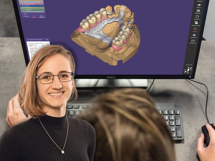 Der digitale Modellguss in Exocad – Designen in der Partial CADapp mit Adriana