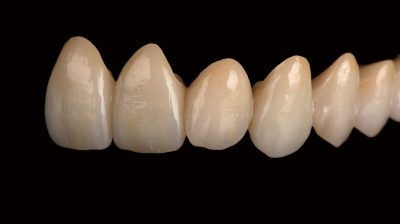 pritidenta