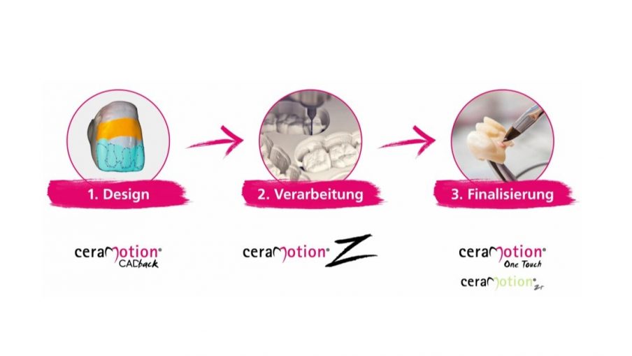 ceraMotion-Workflow von Dentaurum: effizienter, flexibler, digital